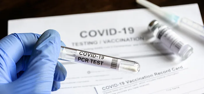 Atualização da nota informativa sobre diagnóstico Laboratorial COVID-19