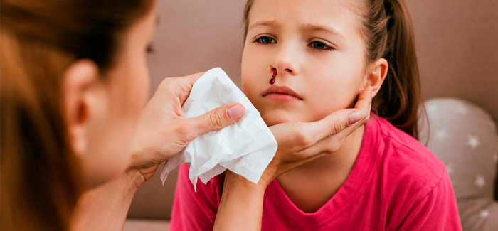 Sangramento nasal no calor: como agir e o que não deve fazer